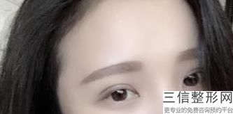 上海九院做双眼皮专家排名,2022上海九院做双眼皮专家排名实力上榜