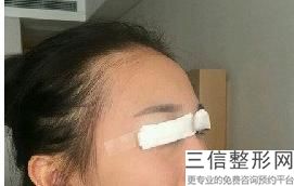 上海开眼角医生排名榜前十名单发布,2022王俊芳医生实力超强