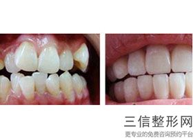 上海口腔科公立医院排名前十榜单,2022上海第九人民医院口腔科实力超强