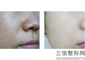 上海拉皮除皱美容专家排名前十,2022杨娴娴实力上榜