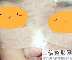 上海肋骨隆鼻鼻王名单公布,2022沈国雄口碑良好
