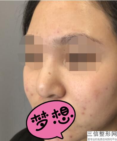 上海肋骨隆鼻医生排行榜八大知名专家揭晓,2022陈斌锁定前十