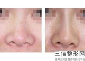 上海隆鼻比较好的医院排名前七发布,2022上海伊莱美医疗美容医院不容错过