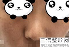 上海隆鼻前十名医生排行榜名单介绍,2022赵延峰遥遥领先