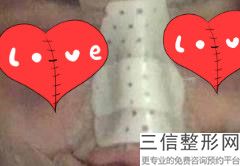 上海隆鼻前十位整形医院排名公开,2022上海玫瑰医疗美容医院实力超强