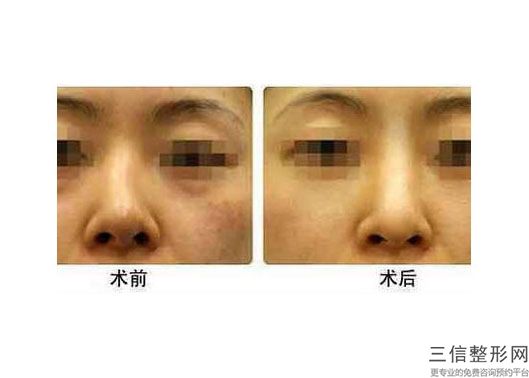 上海隆鼻医院排名榜前十权威发布,2022上海华美整形美容医院实力非凡