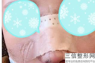 上海隆鼻医院排名前三名单全新发布,2022上海铂诗玥医疗美容诊所锁定前十