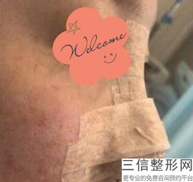 上海隆鼻医院医生排行前三盘点,2022上海第九人民医院整形外科口碑良好