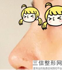 上海隆鼻专家排名前十名单出炉,2022李圣利排名靠前