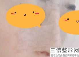 上海隆鼻专家前三名,2022戴传昌医生口碑良好