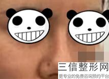 上海隆鼻专家前三名,2022戴传昌医生口碑良好