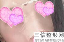 上海隆鼻专家前十名榜单公布,2022苏薇洁锁定前十