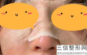 上海隆鼻专家前十名名单公布,2022钱玉鑫医生实力上榜