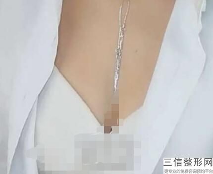 上海隆胸医生排名榜新版出炉,2022朴元辰锁定前十