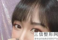 莆田市割双眼皮医院排行榜,2022莆田市人民医院整形外科锁定前十