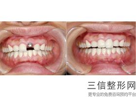 宁波牙科医院排名前五,2022宁波徐茂口腔门诊部排名靠前