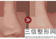 宁波做鼻子整形医院排名表,2022宁波美莱整形美容医院锁定前十