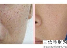 皮肤科东莞医院排名前十榜单发布,2022东莞市人民医院皮肤科口碑不错