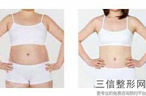 青岛丰胸整形医院排名前八女生必看,2022青岛华韩整形美容医院口碑良好