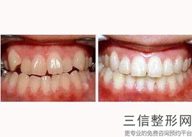 青岛好的口腔医院排行榜前五强评选发布,2022青岛市口腔医院口碑良好