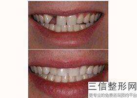 青岛口腔医院排名,2022拜博口腔(青岛总店)遥遥领先