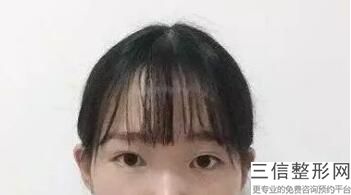 青岛哪个医生做双眼皮好,2022武伟亮医生首次上榜