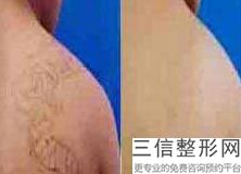 青岛哪家医院做拉皮手术好,2022青岛博士医学美容医院实力入围