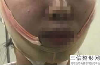 青岛漂唇整形医院排名前十位,2022青岛漂唇整形美容医院排名前十排名靠前