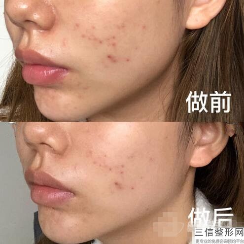 青岛热玛吉正规医院名单发布,2022青岛诺德医疗美容医院排名靠前