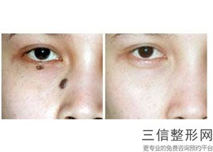 青岛热玛吉正规医院有哪些,2022青岛大学附属医院整形美容科口碑良好