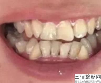 青岛牙齿矫正医院排名前十,2022青岛牙博士口腔门诊部首次上榜