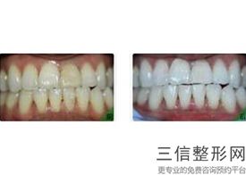 青岛牙齿矫正医院排名前十权威推荐,2022青岛可恩口腔医院口碑不错