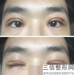 青岛眼部整形医院排名榜单推荐,2022青岛人民医院整形科实力上榜