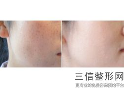 青岛整形医院做拉皮手术排行榜,2022青岛华颜美医疗美容医院实力非凡