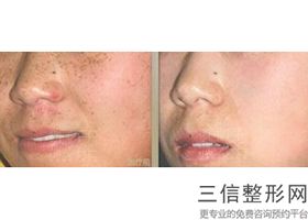 拉皮手术上海哪家医院权威,2022上海百达丽整形医院首次上榜