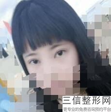 兰州割双眼皮医院排名前五来看看,2022兰州时光整形医院遥遥领先