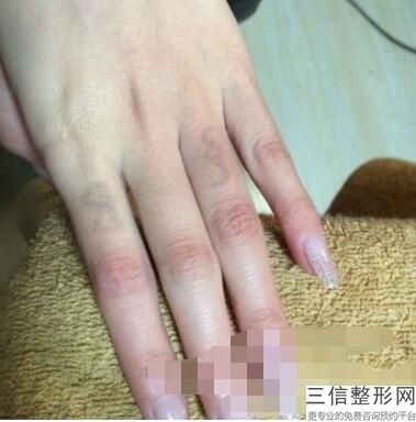 兰州拉皮手术医院排行前十,2022兰州亚韩医学外科医院实力上榜