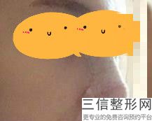 兰州哪家医院看鼻子看的好,2022兰州亚韩医学整形美容医院实力上榜