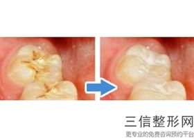 兰州牙医整形医院排名前八强解锁,2022兰州诺贝尔口腔门诊部实力非凡