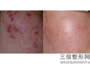 兰州有热玛吉资质正规医院排行前五,2022兰州时光整形外科排名靠前
