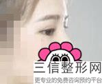 兰州做眼袋整形医院排名榜前五,2022甘肃省人民医院整形科锁定前十