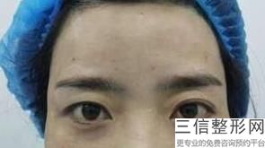乐山去眼袋整形医院排名前五的,2022柏雅秋田医疗美容排名靠前