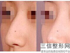 临沂做隆鼻整形医院排榜单,2022临沂微V整美容医院首次上榜