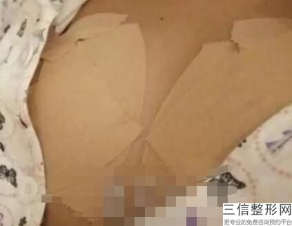 隆胸哪家医院比较好,2022深圳富华整形医院实力上榜