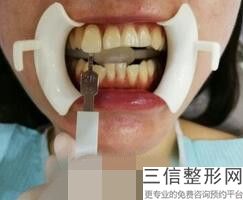 洛阳口腔医院排名前五,2022洛阳解放军534医院美容整形科位列前十