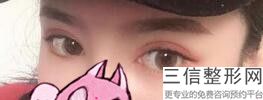洛阳整形医院有哪些做双眼皮好,2022洛阳中心医院整形美容中心位列前十