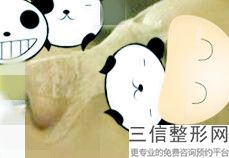 南昌隆鼻医生排行前三强一一细数,2022徐永安锁定前十