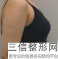 南昌做隆胸整形医院排行榜,2022南昌大学医疗美容门诊部位列前十