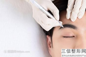 南昌做面部吸脂好的医生介绍,2022郭学永医生锁定前十