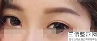 南充比较好的双眼皮整形机构排名,2022南充阿蓝整形位列前十